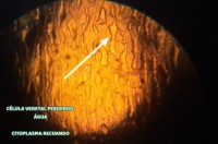 /album/aula-patica-sobre-osmose-2%c2%ba-anos/a13-jpg1/